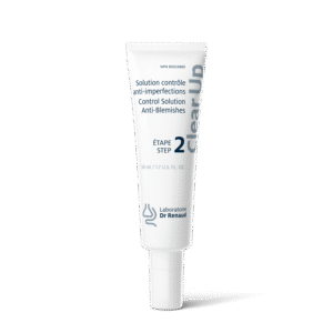 Solution contrôle anti-imperfections Étape 2